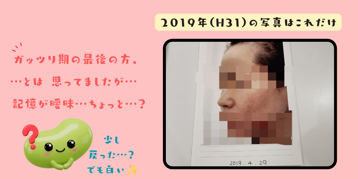 2019年4月29日に撮影された顔写真。「2019年（H31）の写真はこれだけ」「ガッツリ期の最後の方、…とは思ってましたが…記憶が曖昧…ちょっと…？」「少し戻った…？でも白い」と豆実のイラスト付きで書き添えてある（顔はモザイク加工）